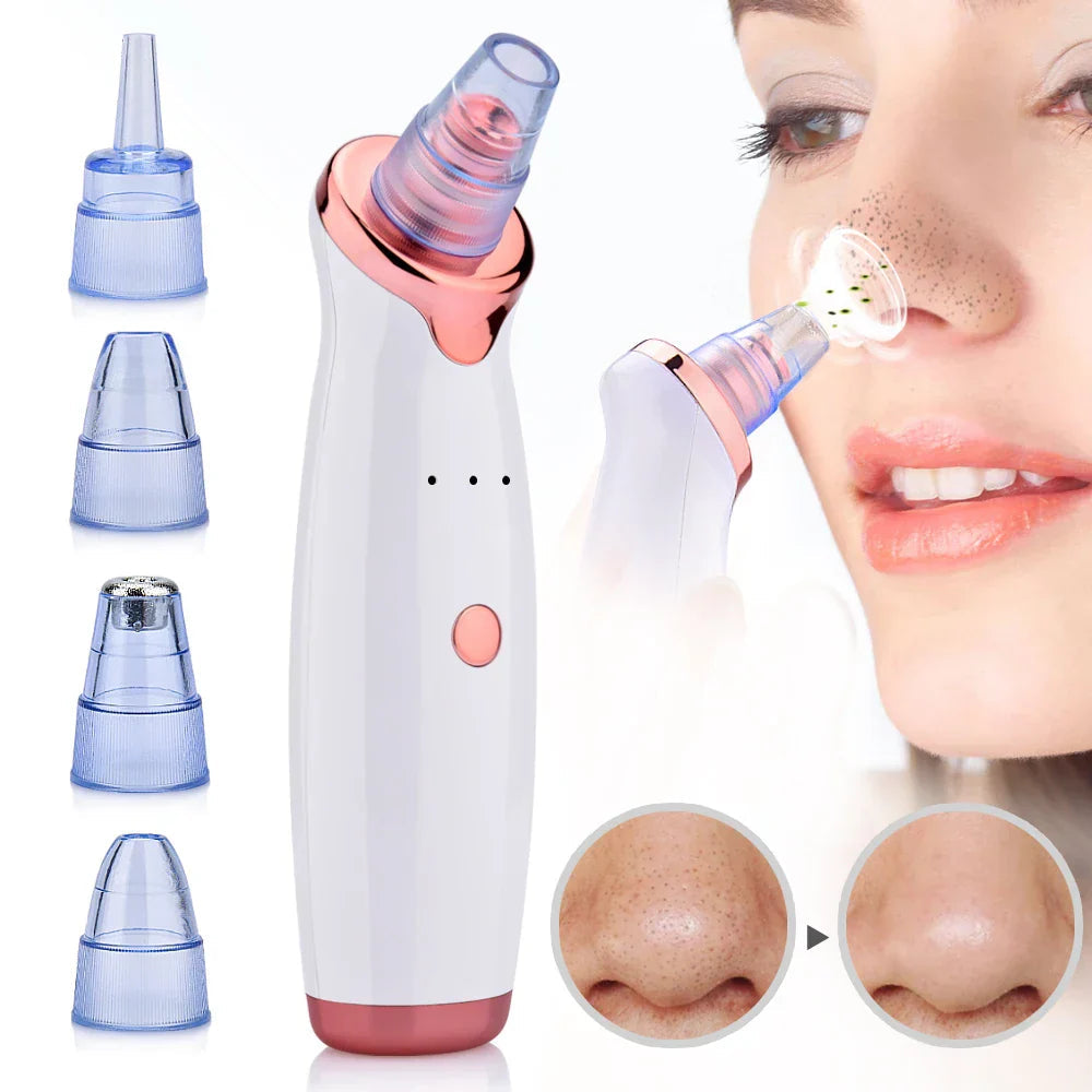 Advanced Blackhead Removal Tool Vacuum | Effective Pore Cleaner for Clearer Skin 1